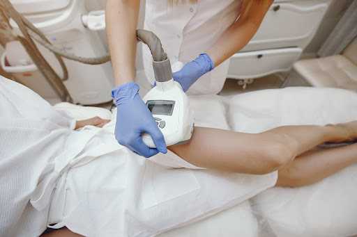 Laser treatments for cellulite